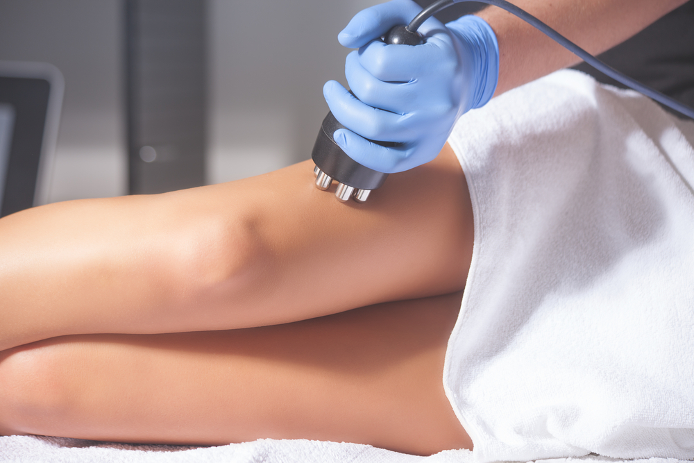 Cellulite Treatment las vegas