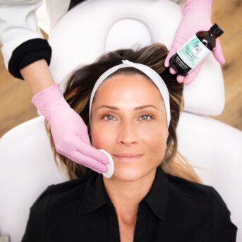 chemical-peels